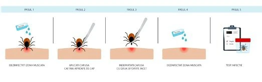 Pași ilustrați pentru îndepărtarea corectă a căpușei din piele